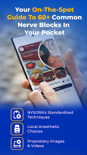 NYSORA Nerve Blocks PC