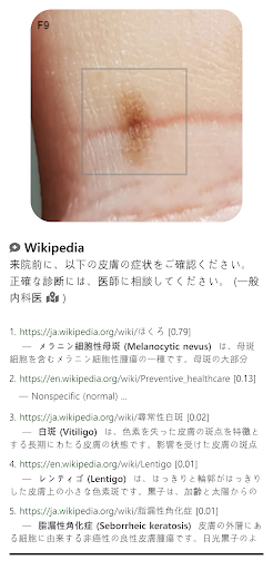 Model Dermatol – 皮膚疾患 PC版