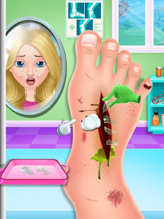 Nail & Foot doctor - Knee replacement surgery الحاسوب