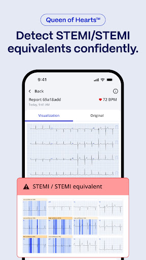 PMcardio for Individuals PC