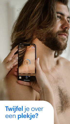 SkinVision - herken huidkanker PC