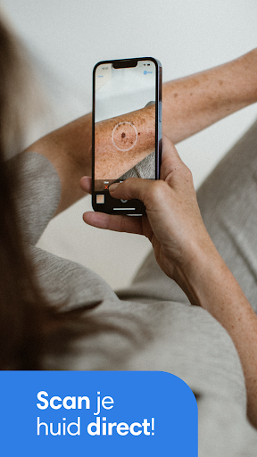 SkinVision - herken huidkanker PC