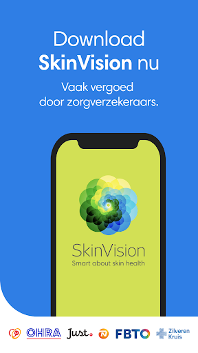 SkinVision - herken huidkanker PC