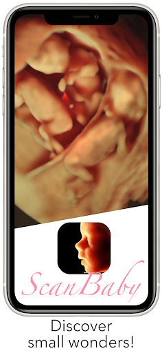 ScanBaby learn baby ultrasound PC