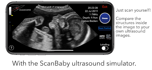 ScanBaby learn baby ultrasound PC