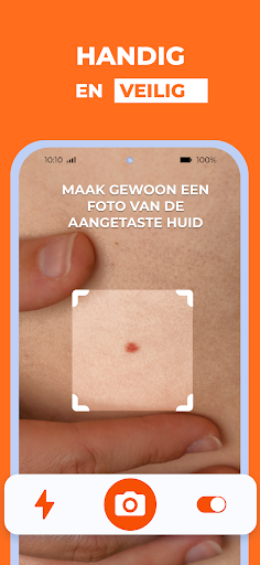 AI Huidmonitor scan - Skinive PC