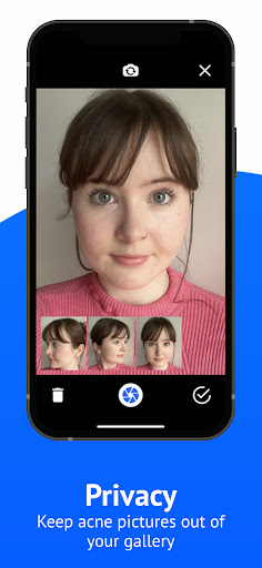 SkinTheory Skin + Acne Tracker PC