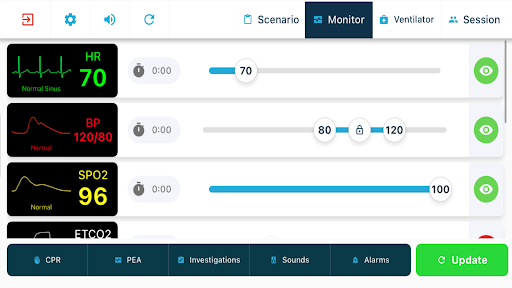 TruMonitor - TruVent