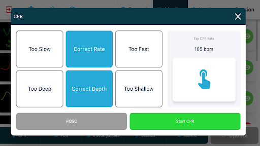 TruMonitor - TruVent