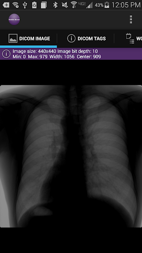 Mobile Dicom Viewer ПК