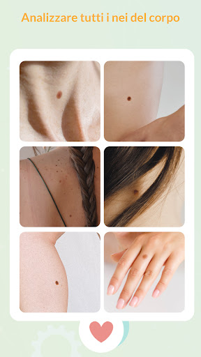 Medic Scanner - analisi pelle PC