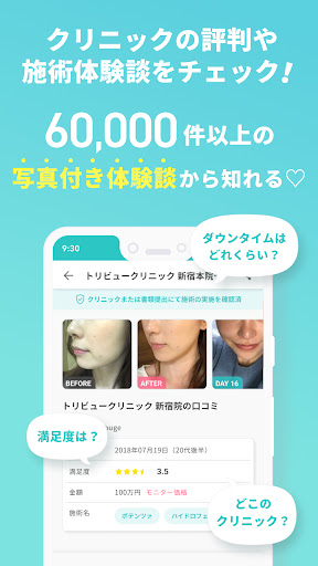 トリビュー（美容 医療の口コミ予約アプリ） PC版