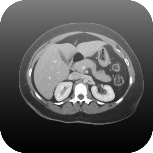 Radiology CT Viewer