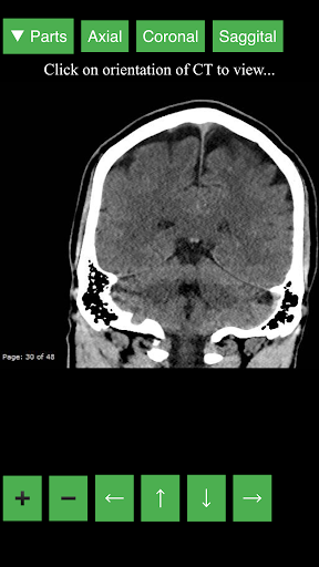 Radiology CT Viewer