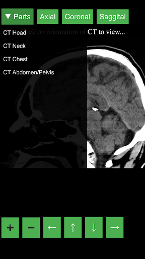 Radiology CT Viewer