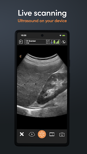 App Clarius Ultrasound PC
