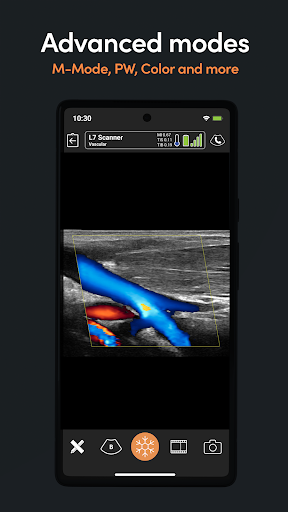 App Clarius Ultrasound PC