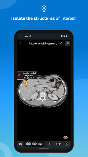 e-Anatomy পিসি