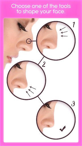 Rinoplastia