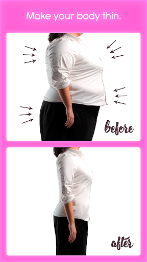 Rinoplastia
