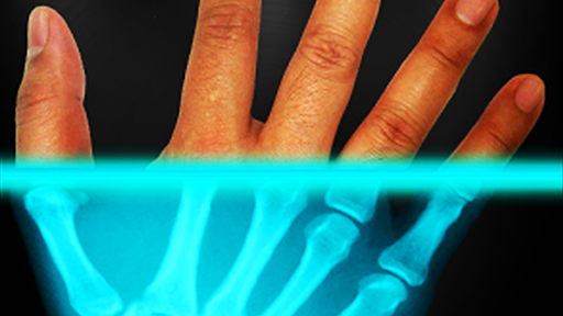 XRAY filter for images